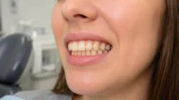 Is Summer a Good Time to Start Invisalign in Milpitas?